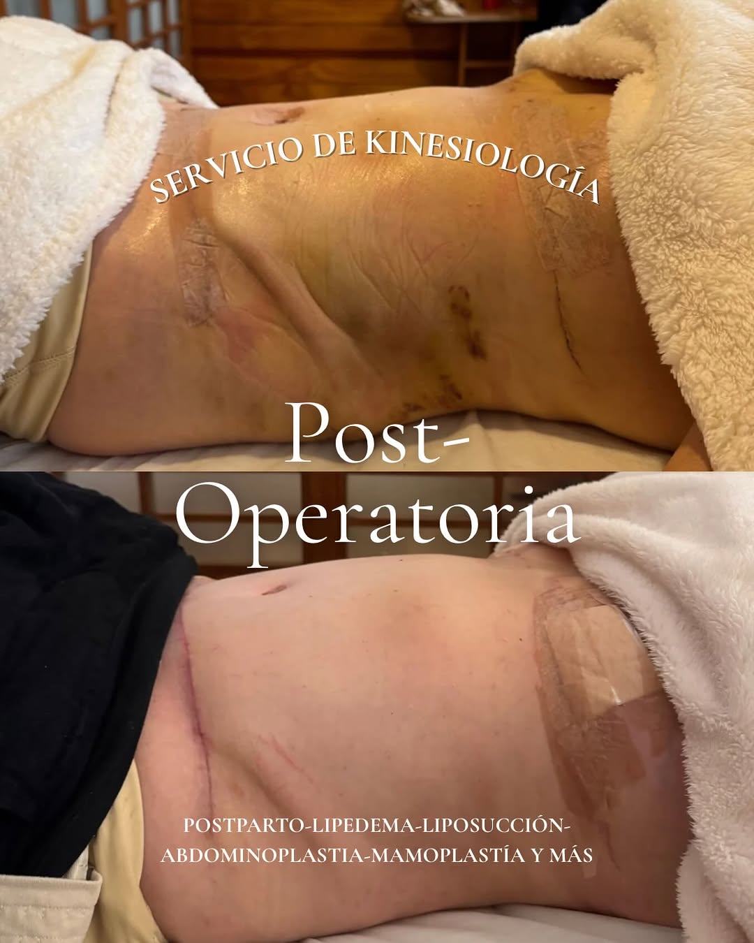 Kinesiología post operatoria
